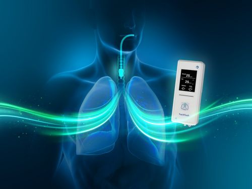 Pressemitteilung – Kooperation mit AW Technologies