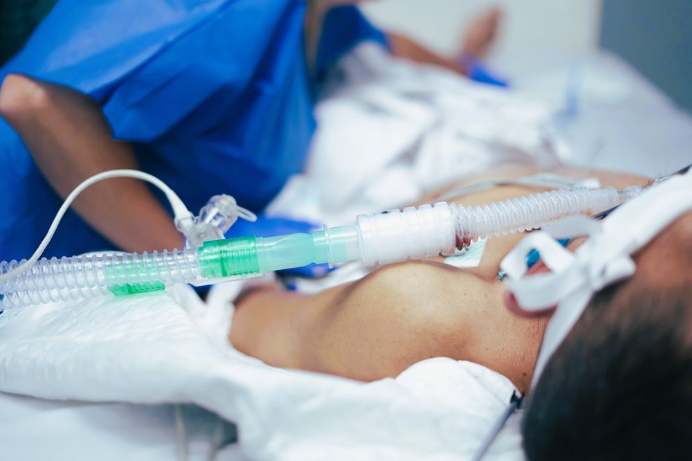 TrachFlush: Automatisierte Cuffdruck-Kontrolle mit integrierter Sekretmanagement-Funktion